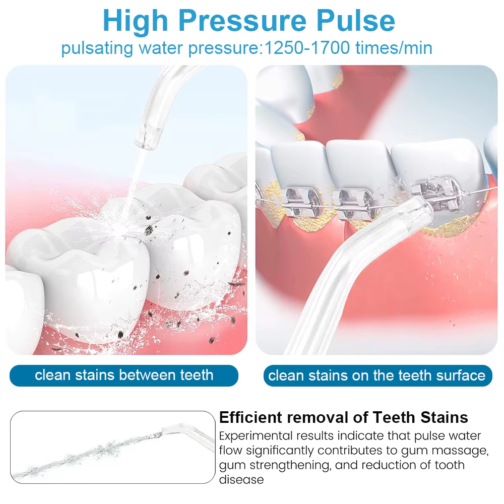 High Pressure Electric Dental Water Flosser – 800ML Oral Irrigator with 10 Adjustable Modes & 5 Jet Tips - 图片 5