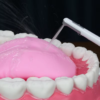 Dental Water Flosser – Portable Faucet Oral Irrigator for Teeth Cleaning and Braces Care - 图片 4